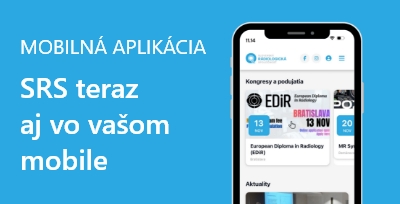 Mobilná aplikácia SRS