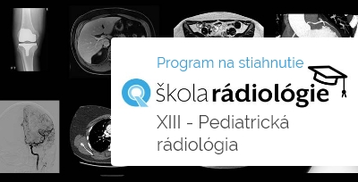Škola rádiológie 13 – zverejnený program