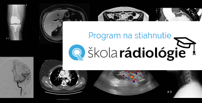   Program Školy rádiológie 1 a 2 je už k dispozícii
