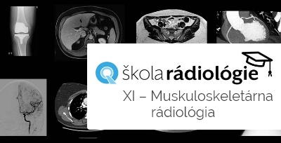 Škola rádiológie XI - Muskuloskeletálna rádiológia