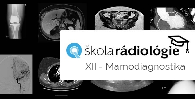 Škola rádiológie XII - Mamodiagnostika